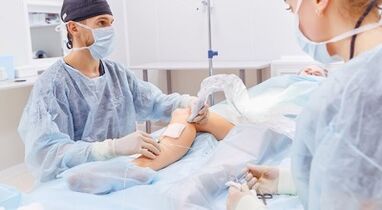 Surgery for varicose veins