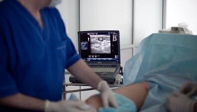 Surgical treatment of varicose veins