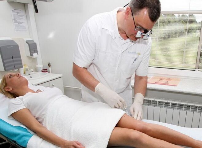 Sclerotherapy
