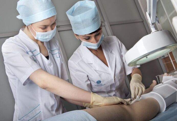 Performing surgery for varicose veins on legs