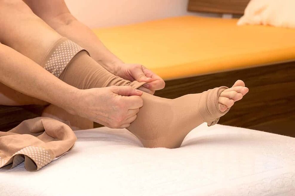 The use of compression stockings will help alleviate the manifestations of varicose veins. 